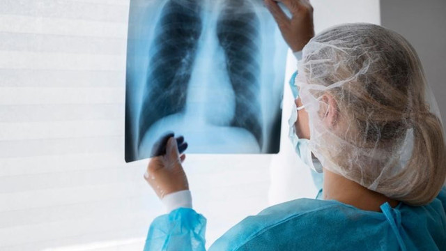 CNAM: 27 de persoane cu tuberculoză confirmată au fost incluse în tratament
