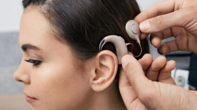 CNAM: 64 de persoane au beneficiat de implant cohlear gratuit în 2025

