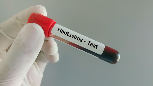 Spania anunță că a depistat un caz suspect de hantavirus în Alicante